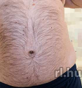 Dante (45+ éves) - Telefon: +36 30 / 839-0934 - Budapest