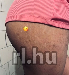 Évikee11 (20 éves) - Telefon: +36 30 / 729-1602 - Budapest, XIII