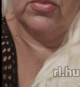 Budapest, H�zasp�r 06304581825