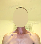 Koml, Isti44 06205817246