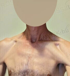 Koml, Isti44 06205817246