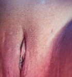 Gyngys, Jzmin 06302667260