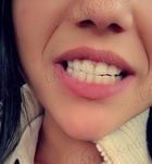 KicsiiLány (26 éves) - Telefon: +36 20 / 915-6613 - Budapest, III