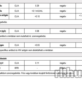 Lívia (39 éves) - Telefon: +36 30 / 534-5285 - Budapest, XV