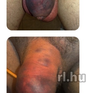 Budapest, Onace 06204474026