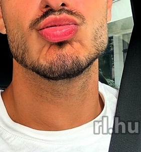 Patrik Hódmezővásárhely escort Mädchen