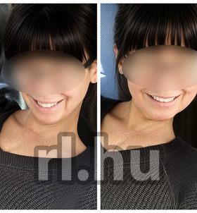 Vera Eger escort girls